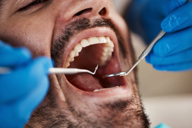Best Emergency Gum Treatment in Fort Mitchell, KY