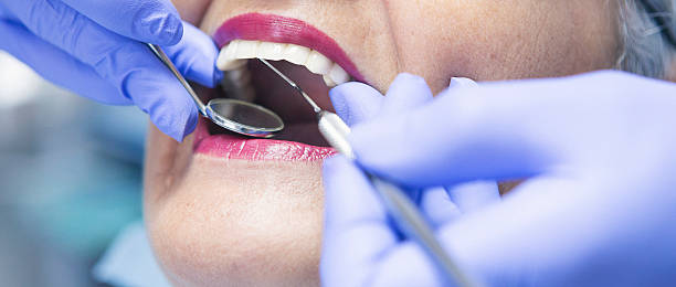 Best Emergency Dental Care for Broken or Chipped Teeth in Fort Mitchell, KY